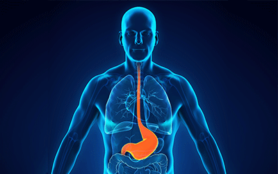 Heartburn Treatment Clinic